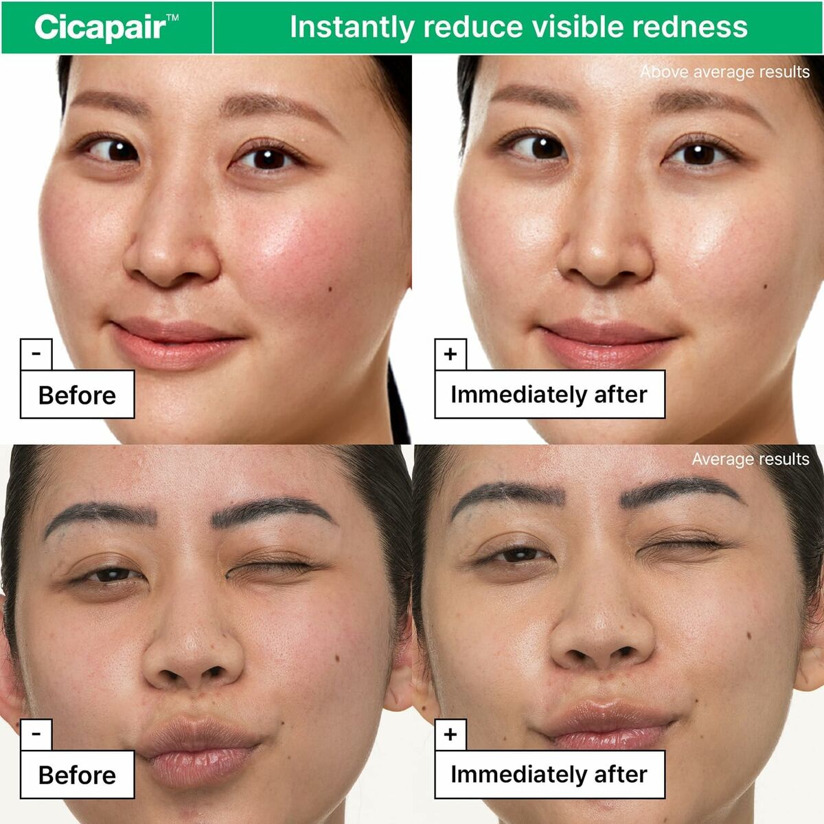 Before and after results using DR.JART+ CICAPAIR cream to reduce visible redness on sensitive skin.
